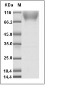 EphA2 Protein, Human, Recombinant (His & Avi), Biotinylated