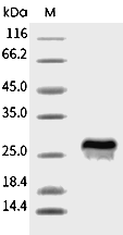 VEGF165 Protein, Human, Recombinant (His & Avi), Biotinylated
