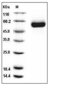 DLL1 Protein, Human, Recombinant (His)