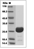 HIV-1 (group O, strain BCF06) p24 Protein (His)