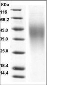 IL-18BP Protein, Mouse, Recombinant (His)