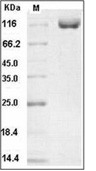 DPP4/CD26 Protein, Human, Recombinant (hFc)
