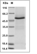 TRIM21 Protein, Human, Recombinant (His)