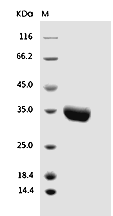 EPOR Protein, Human, Recombinant (His)
