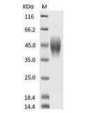 IL-4R Protein, Human, Recombinant (His)