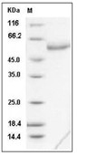 Influenza A H1N1 (A/California/04/2009) Neuraminidase/NA (His)