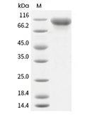 EGFR Protein, Human, Recombinant (His)