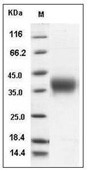 ACVR2A Protein, Human, Recombinant (His)