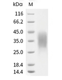 B7-H5/VISTA Protein, Human, Recombinant (His)