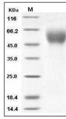 CD200R Protein, Human, Recombinant (His)