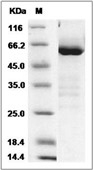 CD73/5'-Nucleotidase Protein, Rat, Recombinant (His)