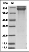 Integrin alpha V beta 6 Protein, Mouse, Recombinant (Flag & His)