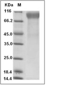 HER2/ERBB2 Protein, Human, Recombinant , Biotinylated