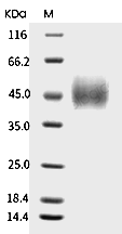 CD89 Protein, Human, Recombinant (His)