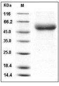 IL-18R beta/IL-18RAP Protein, Human, Recombinant (His)