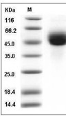 Influenza A H1N1 (A/Puerto Rico/8/1934) Hemagglutinin Protein (His)