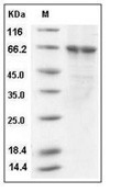 PLK1 Protein, Human, Recombinant (His)
