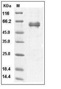 Noggin/NOG Protein, Human, Recombinant (hFc)