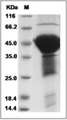 Fetal-tau Protein, Human, Recombinant (His)