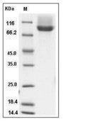 Neuropilin-1 Protein, Human, Recombinant (isoform b, His)