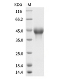 CD25/IL2R alpha Protein, Human, Recombinant (His)