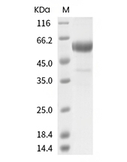 Influenza A H3N2 (A/Kansas/14/2017) Neuraminidase/NA Protein (His)