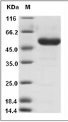 ROR2 Protein, Human, Recombinant (His)