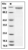 HER2/ERBB2 Protein, Mouse, Recombinant (His)