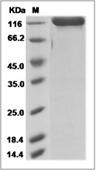DPP4/CD26 Protein, Mouse, Recombinant (hFc)