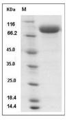 Influenza A H3N2 (A/Perth/16/2009) Hemagglutinin/HA Protein (His)