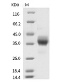 EpCAM/TROP1 Protein, Human, Recombinant (His)