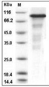 IRE1 Protein, Human, Recombinant (aa 465-977, His & GST)