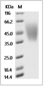 CEACAM6 Protein, Cynomolgus, Recombinant (His)