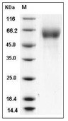 FGFR4 Protein, Human, Recombinant (His)