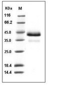 Cathepsin B Protein, Human, Recombinant (His)