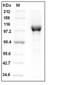 PARP1 Protein, Human, Recombinant (His)