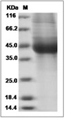 IL-17RB Protein, Human, Recombinant (His)