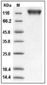 Mer Protein, Human, Recombinant (His & hFc)