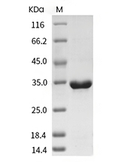 IL-1 beta/IL-1F2 Protein, Human, Recombinant (His)