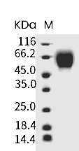 IFNAR1 Protein, Human, Recombinant (His)