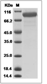 HER2/ERBB2 Protein, Canine, Recombinant (His)
