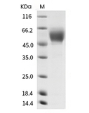 IL-3R alpha/CD123 Protein, Human, Recombinant (His)