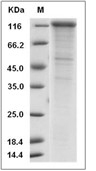 Cadherin 17/CDH17 Protein, Rat, Recombinant (His)