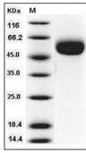 IL-1R2 Protein, Human, Recombinant (His)