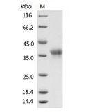 FOLR1 Protein, Human, Recombinant (His)