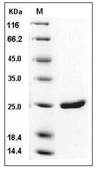 HIV-1 (group M, subtype B, strain 92418) p24 Protein (His)