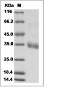 MERS-CoV Spike/RBD Protein fragment (aa 367-606, His)