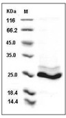 KRAS Protein,Human, Recombinant (Q61H, His)
