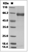 Influenza B (B/PHUKET/3073/2013) Neuraminidase/NA Protein (His)