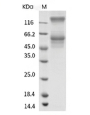 LAG-3 Protein, Cynomolgus, Recombinant (74 Pro, His)